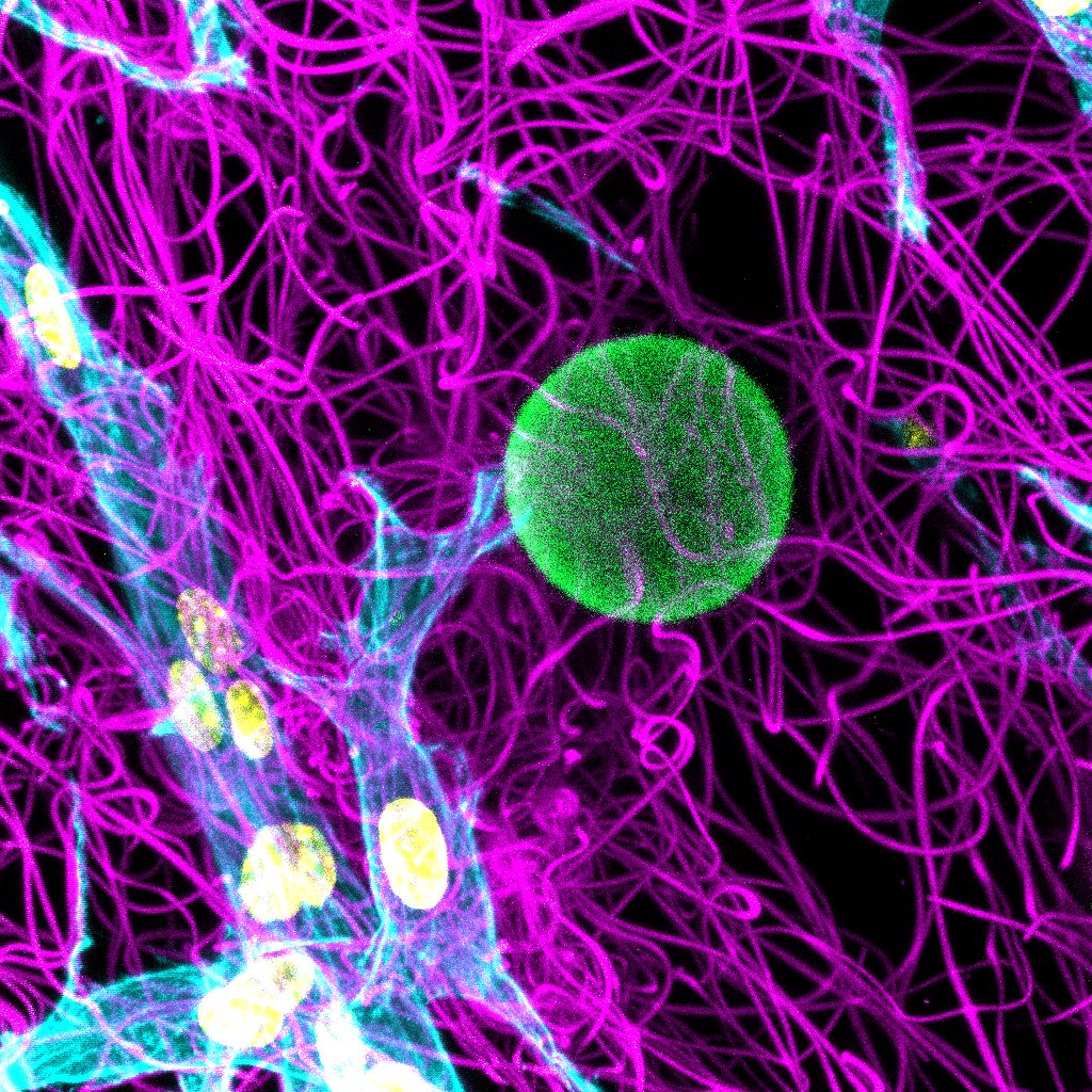 Check out Bobby's new paper at Advanced Functional Materials on GF releasing microgels and composite fibrous hydrogels for recruiting tendon progenitors!  doi.org/10.1002/adfm.2… Many thanks to <a href="/AHHuangLab/">Alice Huang</a>, @megankillian, <a href="/AriellaShikanov/">Ariella Shikanov</a>, and JW Shin for help with this project!