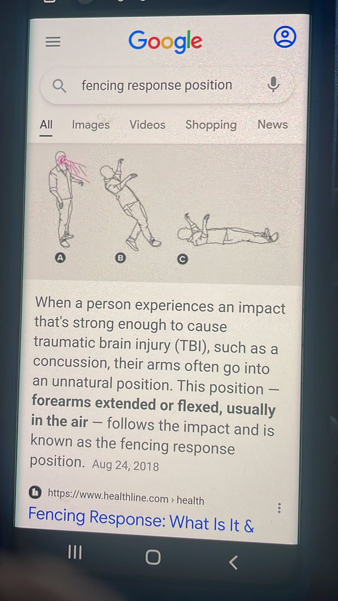 DonDim3lo's tweet photo. A breakdown on what happened to tua @NFL #tnf #TNFonPrime https://t.co/2iJz2VgY6E