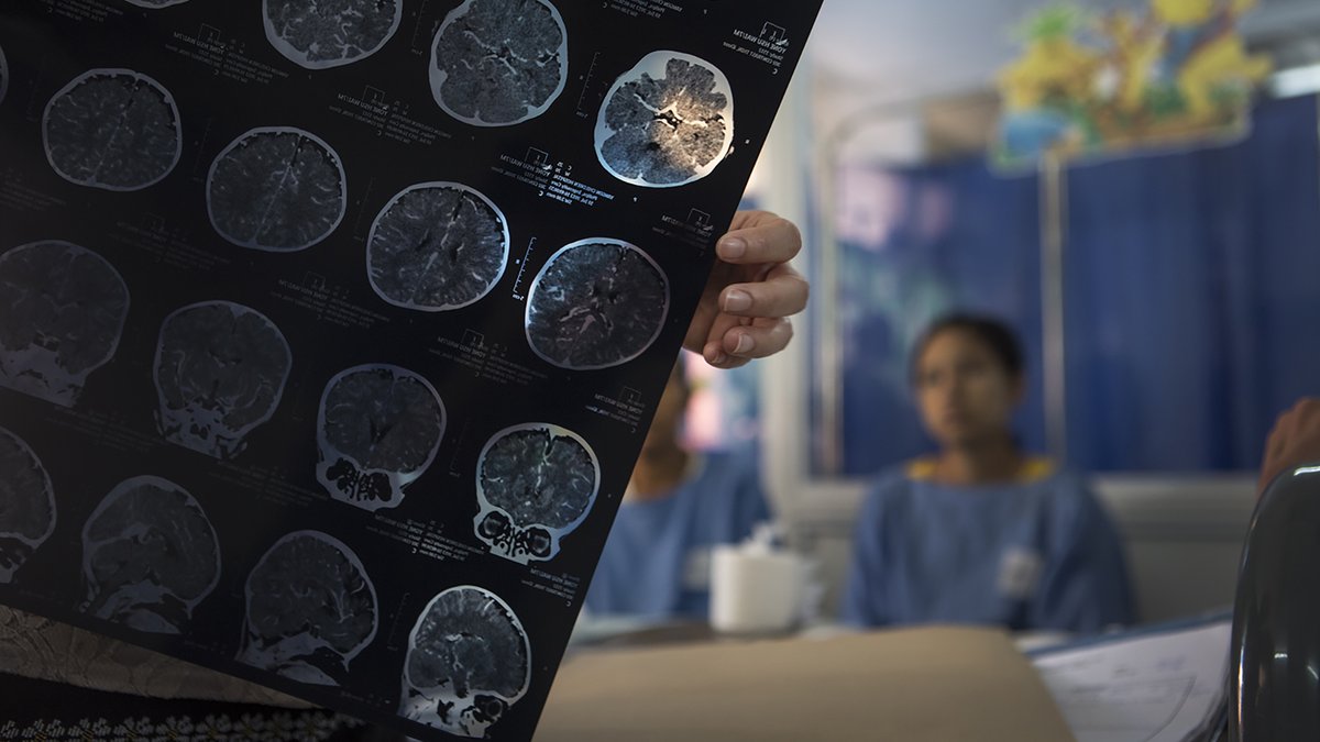 Inria_Saclay's tweet photo. #Biostatistique 🧠 | Kevin Bleakley est chercheur @Inria et statisticien de la grande étude médicale "South East Asia encephalitis" coordonnée par l'@institutpasteur. Il présente les résultats et les limites du traitement statistique des données.
➕https://t.co/5Jc63v0e9i https://t.co/8LCAOLKgo1