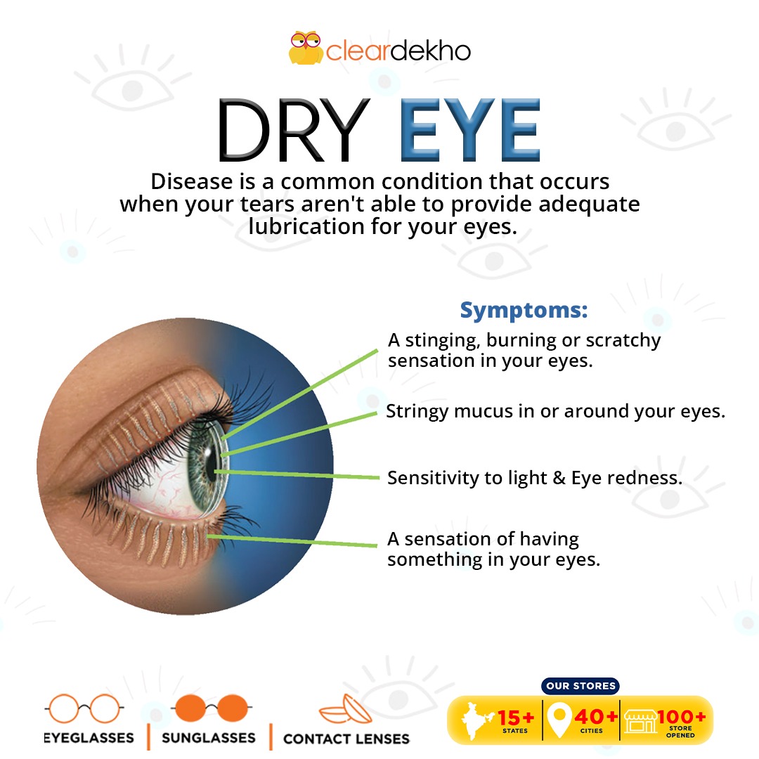 Cleardekho's tweet image. #InformationalPost 📝

Visit the ClearDekho store today. 🚶

15+ states 
40+ cities 
100+ stores.

Order Today 🛍
🌐 cleardekho.com
Or rush 🏃🏻‍♂️ to your nearby store today.

#cleardekho #glasses #eyewear #eyecare #YourSafetyIsPriceless