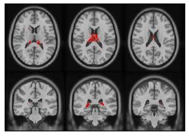 chrastil's tweet photo. 🚨 The lab continues to grow! We are looking for a postdoc and/or a lab manager. Come join us in learning about navigation and the brain!
Details in 🧵
https://t.co/GM7XLMtGqU https://t.co/rBiAsElHwR