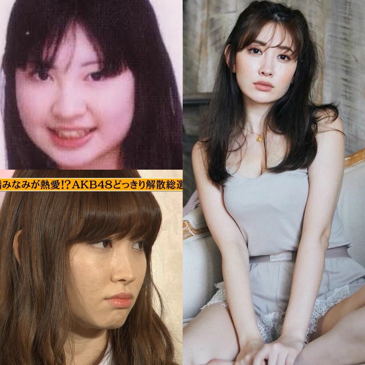 小嶋 陽 菜 整形