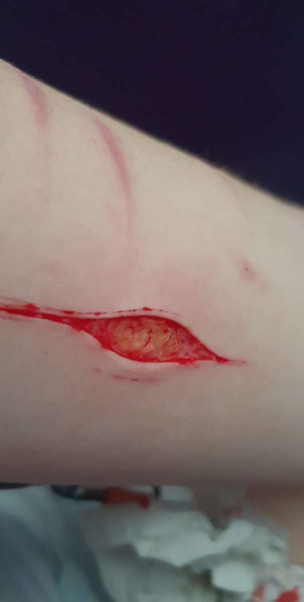 proshtwt's tweet photo. SPX MAKEUP!!!!

NOT REAL

now this is a work of art. Only a few but 3 on thigh and 1 on arm,that's the deepest I've gone before!! I'm so happy hehe. Just have to hide it now https://t.co/7kThP8FpNN