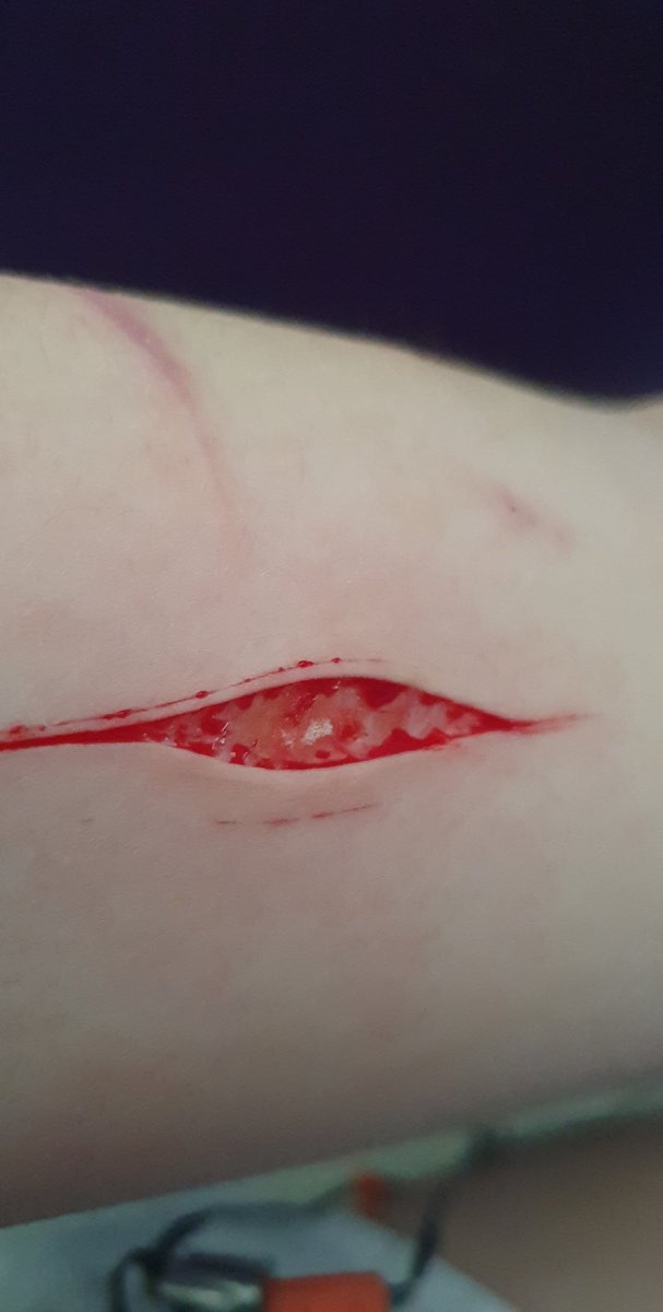 proshtwt's tweet photo. SPX MAKEUP!!!!

NOT REAL

now this is a work of art. Only a few but 3 on thigh and 1 on arm,that's the deepest I've gone before!! I'm so happy hehe. Just have to hide it now https://t.co/7kThP8FpNN