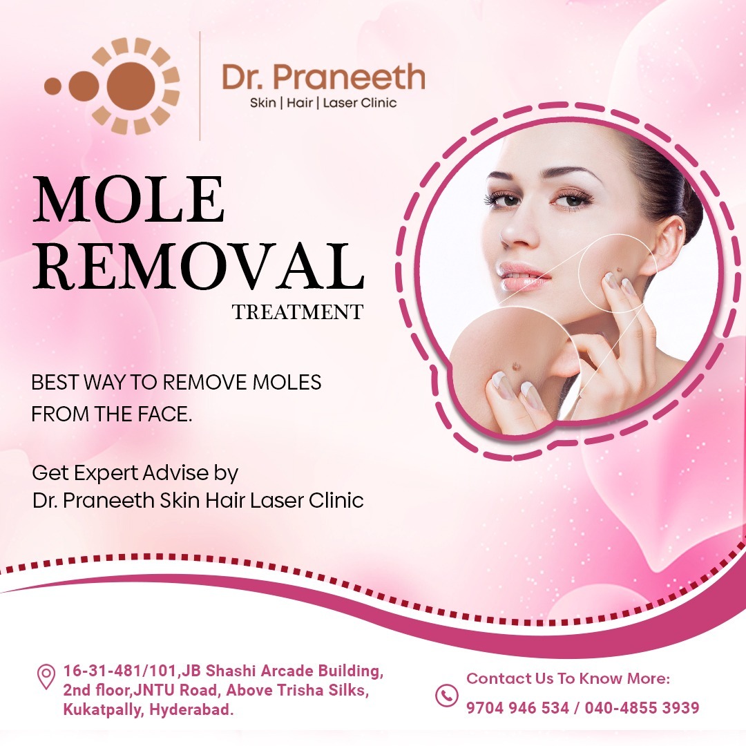 DrPraneethKumar's tweet photo. Mole Removal Treatment 

Visit - https://t.co/9ejlFHOpdt
Book Your Appointment - 9704946534/040-48553939

 #moleremoval #MoleRemovalTreatment #skinappearance #keloids #dermatologistskincare #dermatologisttested #moleskine #moles #KPHB #Hyderabad https://t.co/ZxFkkfAqbN