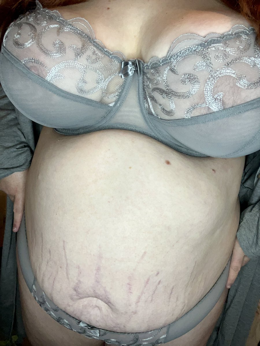 gg_namjoon's tweet photo. Stretch marks are a part of me. And I feel fabulous wearing them in this Gorgeous silver Alice set made by Flirtelle & only available at Brastop. Feeling sexy af π₯ gifted by @Brastop
Iβm wearing 36G
#brastop #lingerieaddict #fullerbust #stretchmarks #warriorstripes #selflove https://t.co/h83bsAdoNQ