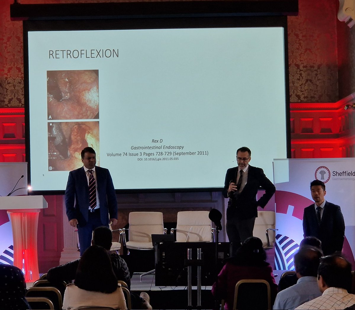 shefgastro's tweet photo. To retroflex or not to #retroflex ? Rectum and caecum?  Perforation rate of around 1 in 10,000 but more #Cancers are picked up earlier! Useful for therapies too! @BritSocGastro @BSGTrainees @gastroendonews https://t.co/1wgPTkxWAS