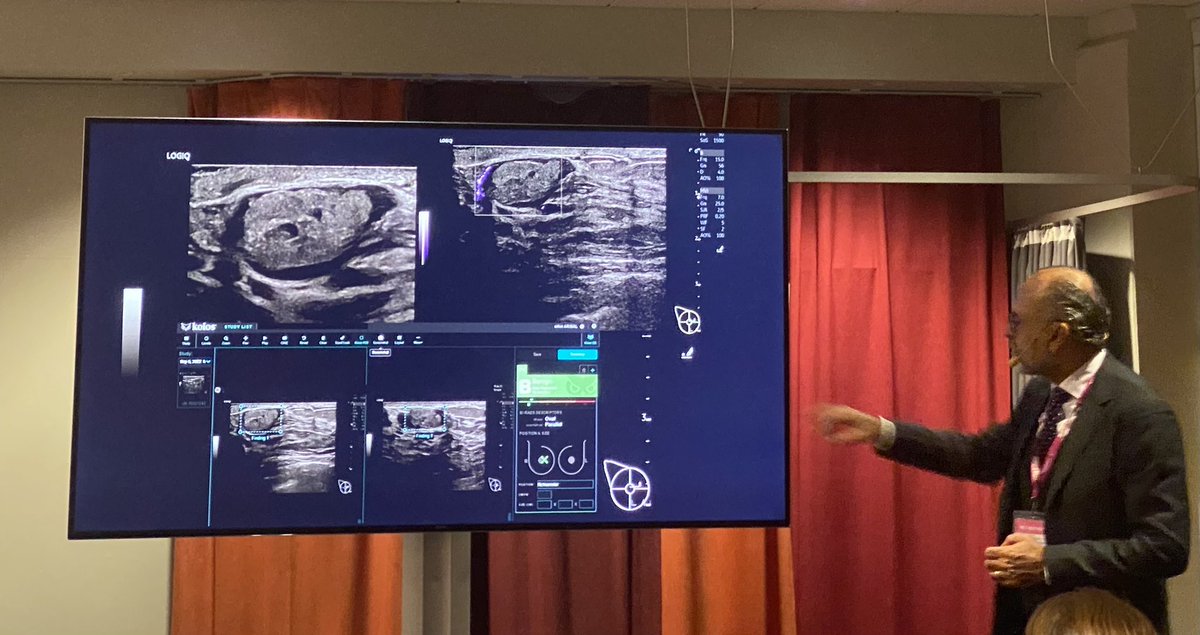 ChadMcClennan's tweet photo. Ai is now about education &amp; training!  Thank you Professor Erkin Aribal sharing compelling data for using Smart Ultrasound in clinical practice @EUSOBIyc @GEHealthcare https://t.co/7nw9uMIpt6
