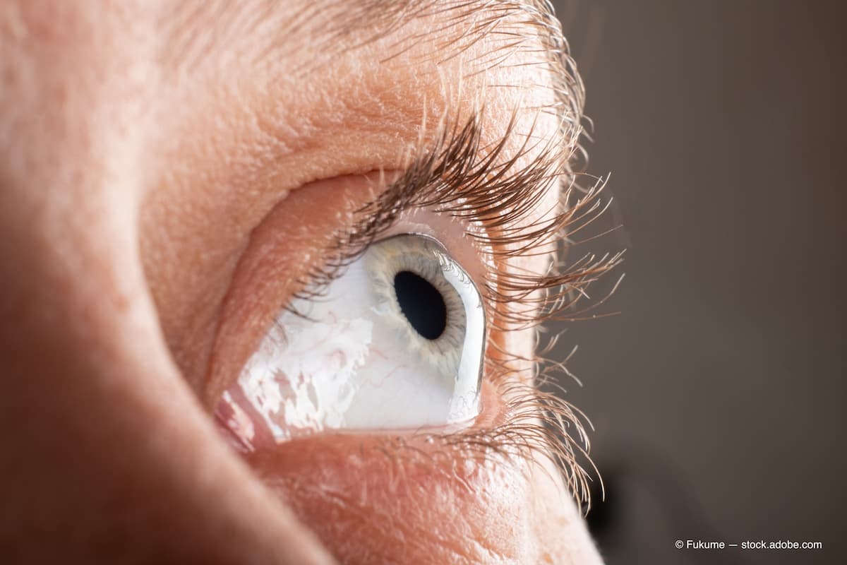 OptometryTimes's tweet photo. Higher-order aberration correction with scleral lenses
More: https://t.co/P0yWwpnlvB
#Optometry #Technology #LensTechnology #Clinical #Cornea @sunyopt https://t.co/i6rwxY0eSo