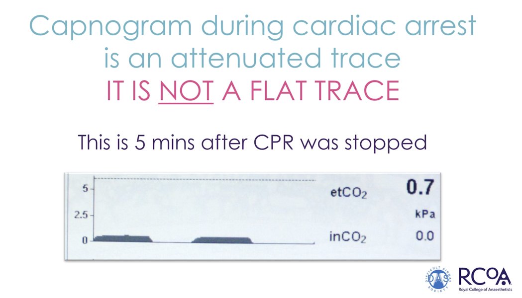 cliffreid's tweet photo. Some STILL need reminding
Capnography: No Trace = Wrong Place
Spread the message from @doctimcook to
All anesthetists
All intensivists
All emergency physicians
All pediatricians who intubate
All cardiac arrest teams
All prehospital teams

https://t.co/KKdrzt1jjV https://t.co/BYXTvSGXJL