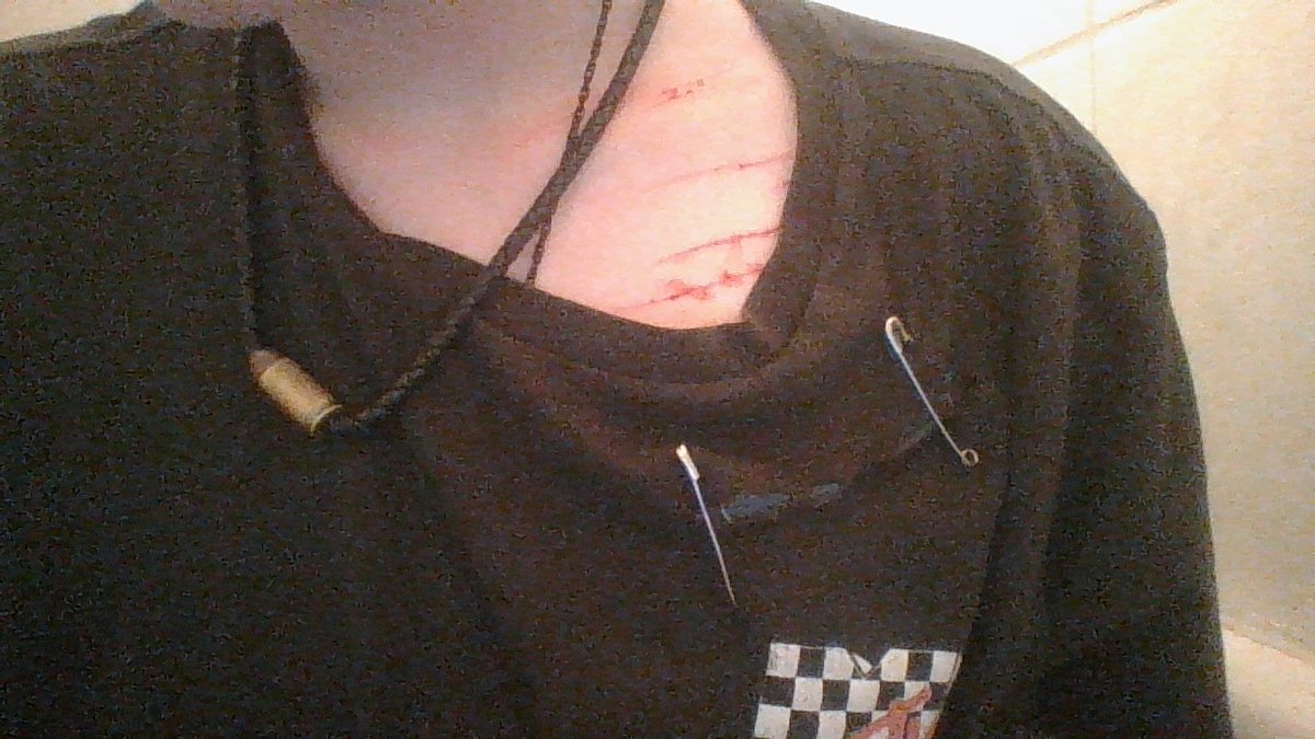chromaticskulls's tweet photo. i think pics on my laptop are cool looking

makeup! not real!!

shtwt goretwt styrotwt beanstwt catscratchtwt barcodetwt ouchietwt sliceytwt https://t.co/nrz2KKaUoJ