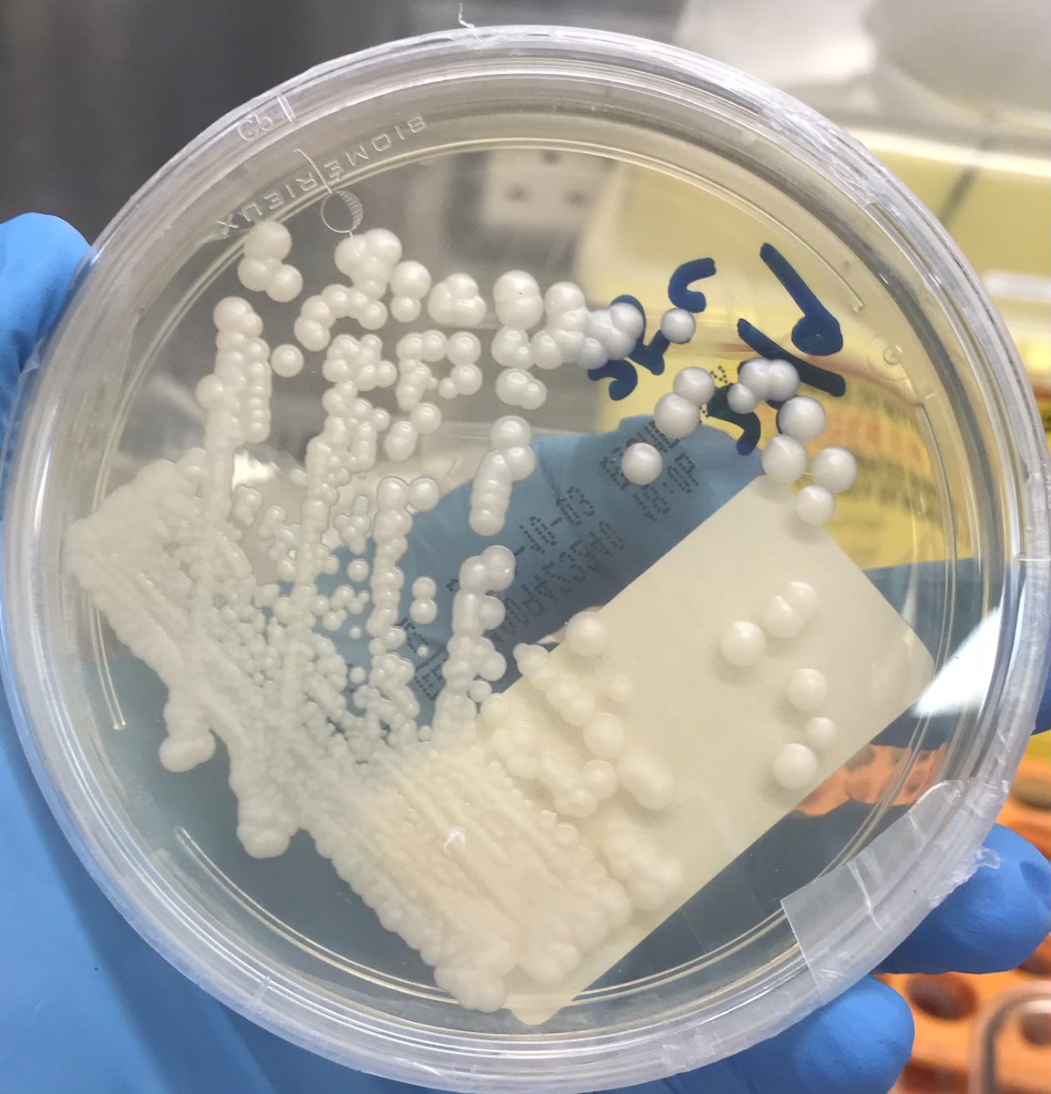 RhodaLeung's tweet photo. Cryptococcus neoformans on Sabouraud agar. India ink was used for negative staining of the encapsulated yeast. #cryptococcus #cryptococcusneoformans #yeast #microbiology #MLT https://t.co/WTFoUSemXv