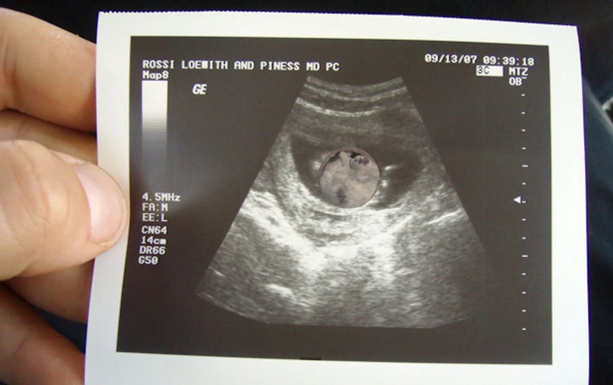 Sonogram