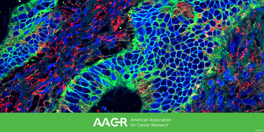 Next-Generation Checkpoints Beyond PD-1 and CTLA-4:
@EvanLipson, Zev Wainberg, and <a href="/RZappasodi/">Roberta Zappasodi</a> will address this topic in a plenary session at the AACR Special Conference on Tumor Immunology and Immunotherapy (Oct 21-24, Boston). Learn more:
bit.ly/3CpoIDz
#AACRtii22