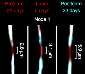 Ethan Hughes (@ethanhugheslab) on Twitter photo The indefatigable <a href="/ClaraBacmeister/">Clara María Bacmeister</a> has done it again. Thrilled to share our latest work out online today <a href="/NatureNeuro/">Nature Neuroscience</a>! Stay tuned for the thread
"Motor learning drives dynamic patterns of intermittent myelination on learning-activated axons"
rdcu.be/cWFPH The indefatigable <a href="/ClaraBacmeister/">Clara María Bacmeister</a> has done it again. Thrilled to share our latest work out online today <a href="/NatureNeuro/">Nature Neuroscience</a>! Stay tuned for the thread
"Motor learning drives dynamic patterns of intermittent myelination on learning-activated axons"
rdcu.be/cWFPH
