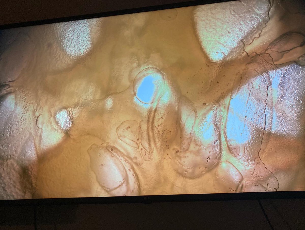 4kStem's tweet photo. Some more incredible photos after viewing everyday objects under the microscope. What do you think we’re looking at? Swipe to see Solana attempting to follow a speedy rotifer under the scope. @STEMcha 

#4kstem #microscopy #rotifer #science #sciencebeast https://t.co/IM8TIKeu0N