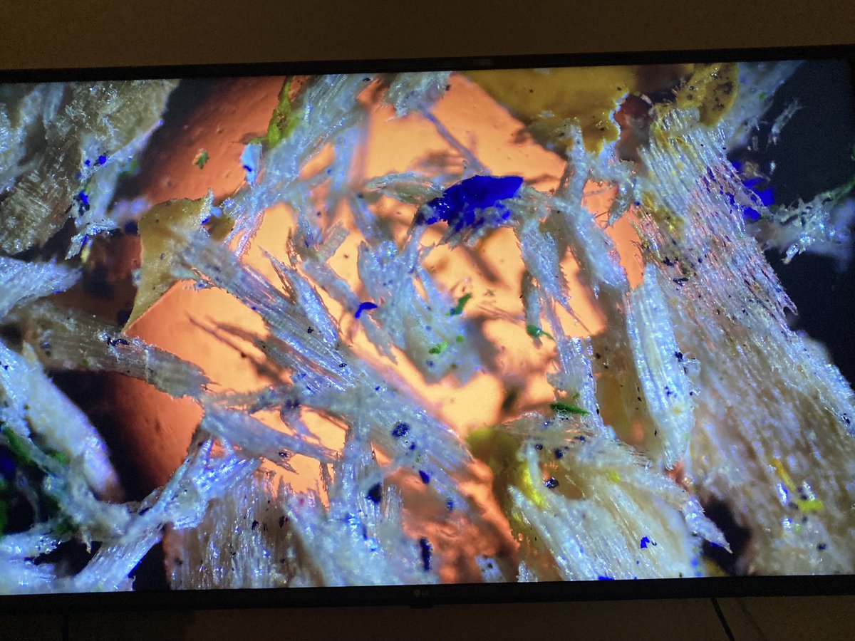 4kStem's tweet photo. Some more incredible photos after viewing everyday objects under the microscope. What do you think we’re looking at? Swipe to see Solana attempting to follow a speedy rotifer under the scope. @STEMcha 

#4kstem #microscopy #rotifer #science #sciencebeast https://t.co/IM8TIKeu0N