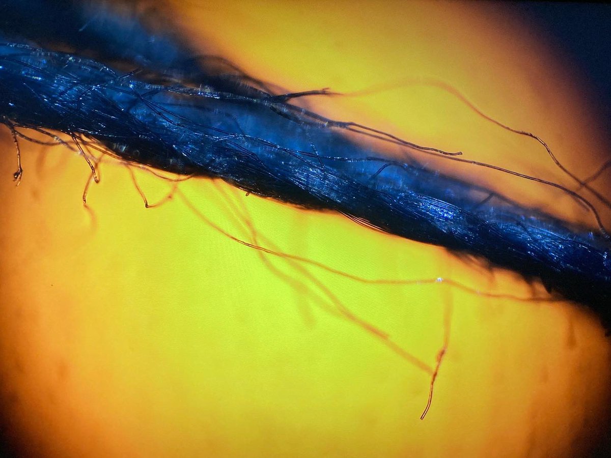 4kStem's tweet photo. Some more incredible photos after viewing everyday objects under the microscope. What do you think we’re looking at? Swipe to see Solana attempting to follow a speedy rotifer under the scope. @STEMcha 

#4kstem #microscopy #rotifer #science #sciencebeast https://t.co/IM8TIKeu0N