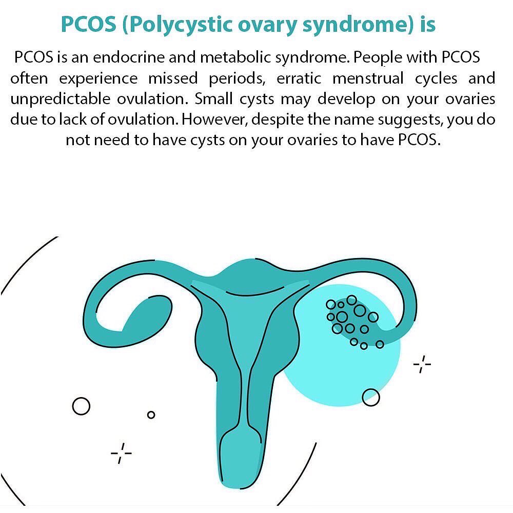 POS_Muse's tweet photo. Marking September as PCOS awarness month, PCOS is still an condition which is not well researched even though every 1 in 5 menstruators are diagnosed in India.
1/n
#AperiodOfSharing #PCOS #PCOSAwarnessMonth https://t.co/zFGIICswxs