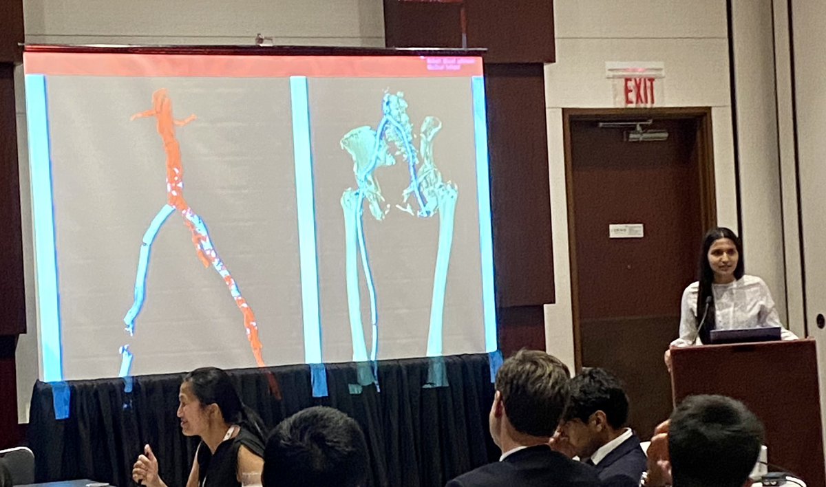BillBeckerman's tweet photo. @RWJMS second year medical student, VSIG President and @FutureVascSurgn Khushi Patel presents a case of a revasc of a pt with nitinol overdose. Warning of the harms when pan-stenting claudicants, especially smoking claudicants, and especially CFA stents. #appropriateuse #EVS2022 https://t.co/Rf6qdlAUNx