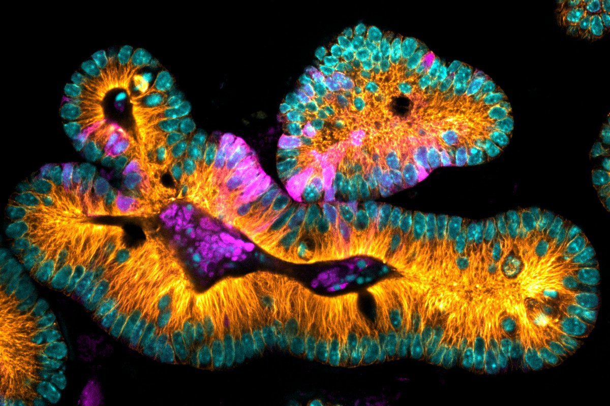Happy #FluorescenceFriday! Check out this image of mouse intestinal organoids. Look at those gorgeous microtubules and mitotic cells!

📷: <a href="/DawneyNicole/">Nicole Dawney</a> from <a href="/BergstralhLab/">Bergstralh Lab</a> 
🔬: <a href="/AndorTechnology/">Oxford Instruments Andor</a> Dragonfly spinning disk confocal