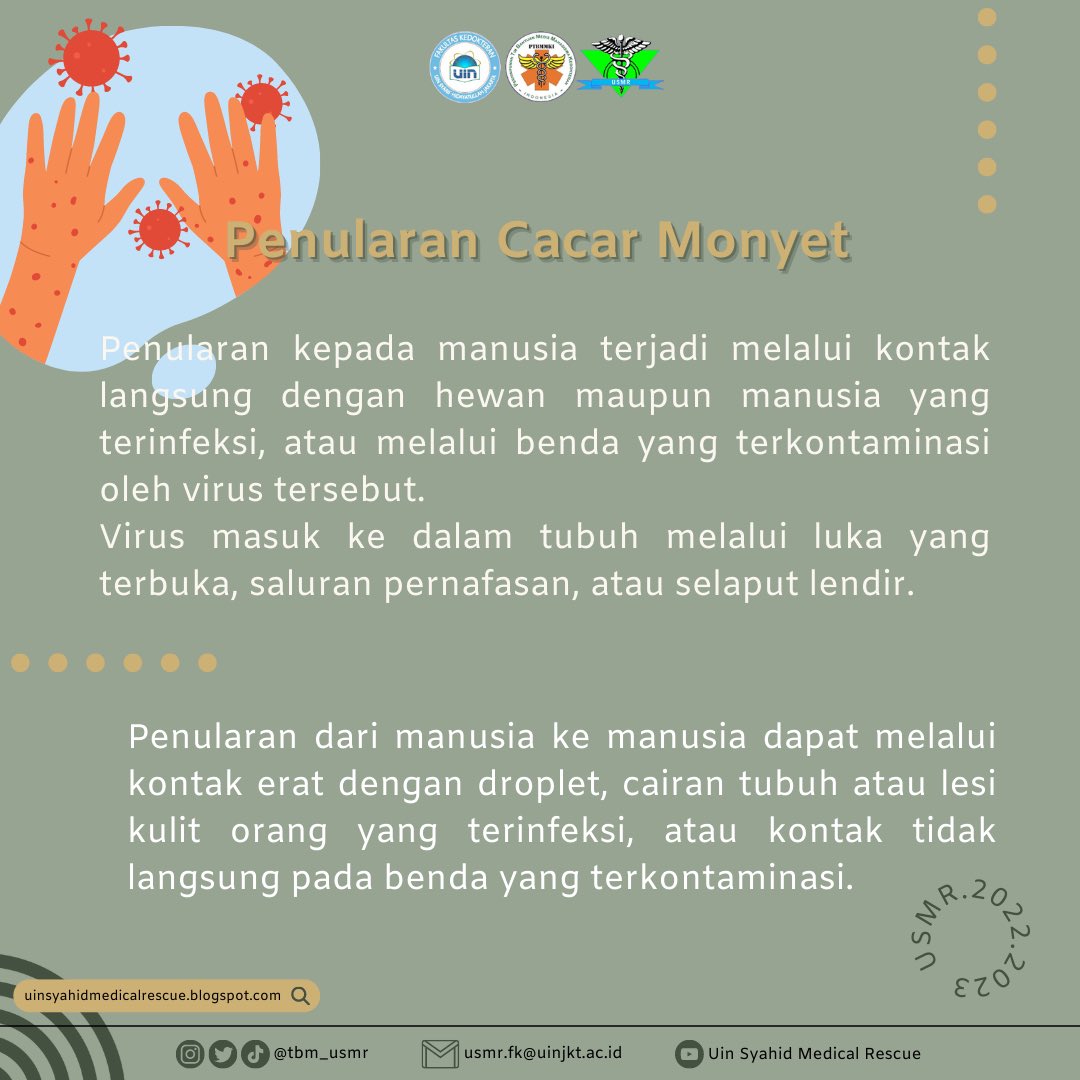 tbm_usmr's tweet photo. || POSTER EDUKASI: CACAR MONYET ||
•
More information:
Instagram: @tbm_usmr
Twitter: @tbm_usmr
Blog: https://t.co/2eBvpcLisG
Email: usmr.fk@uinjkt.ac.id
•
#USMR
#UMSR2022/2023
#uinsyahidmedicalrescue
#siapsigaptanggap https://t.co/LRXcs59ClH