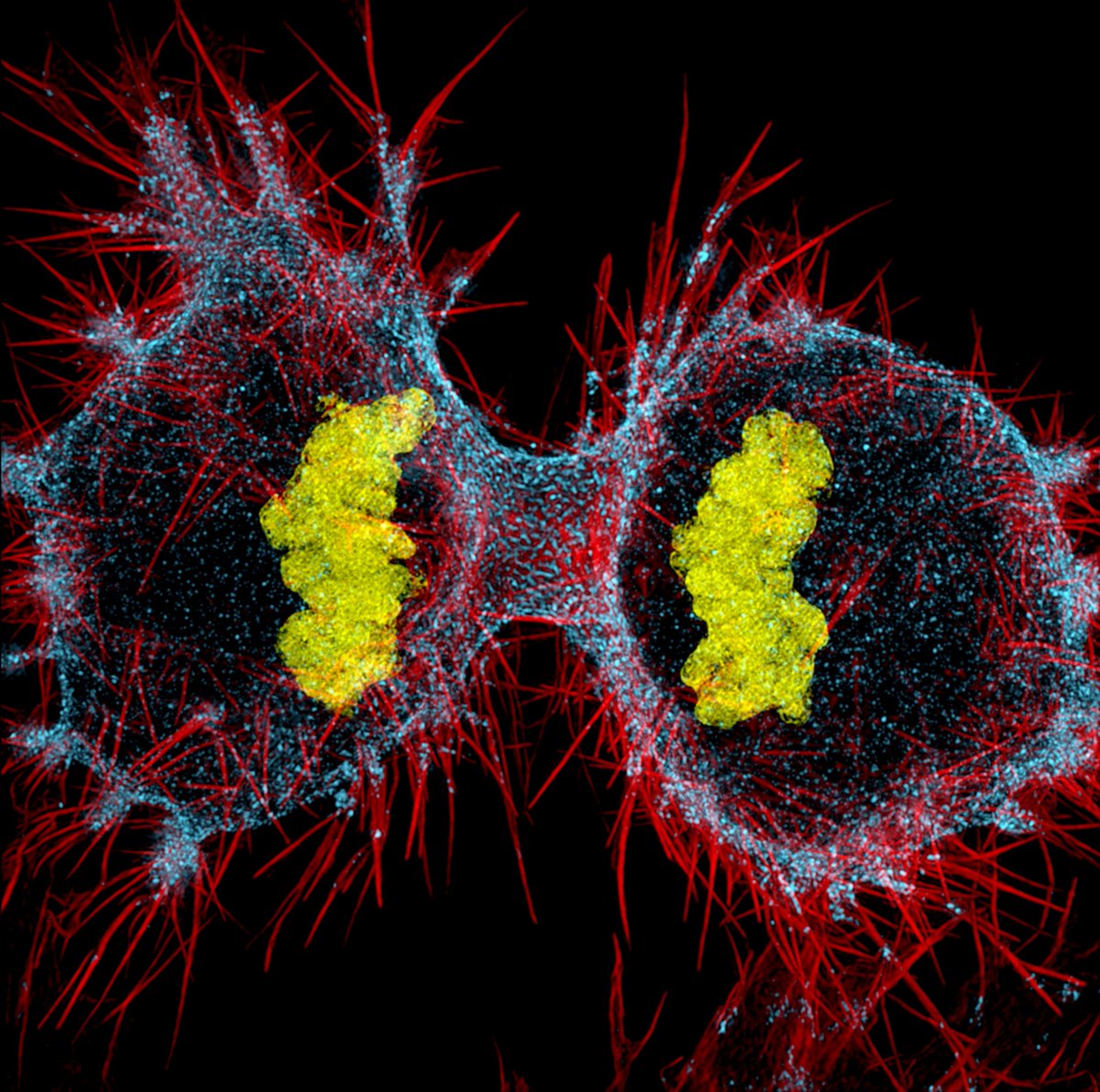 MAG2ART's tweet photo. A mother cell dividing into two daughter cells photographed through a microscope. @NikonSmallWorld https://t.co/Y5IK3FUiV3