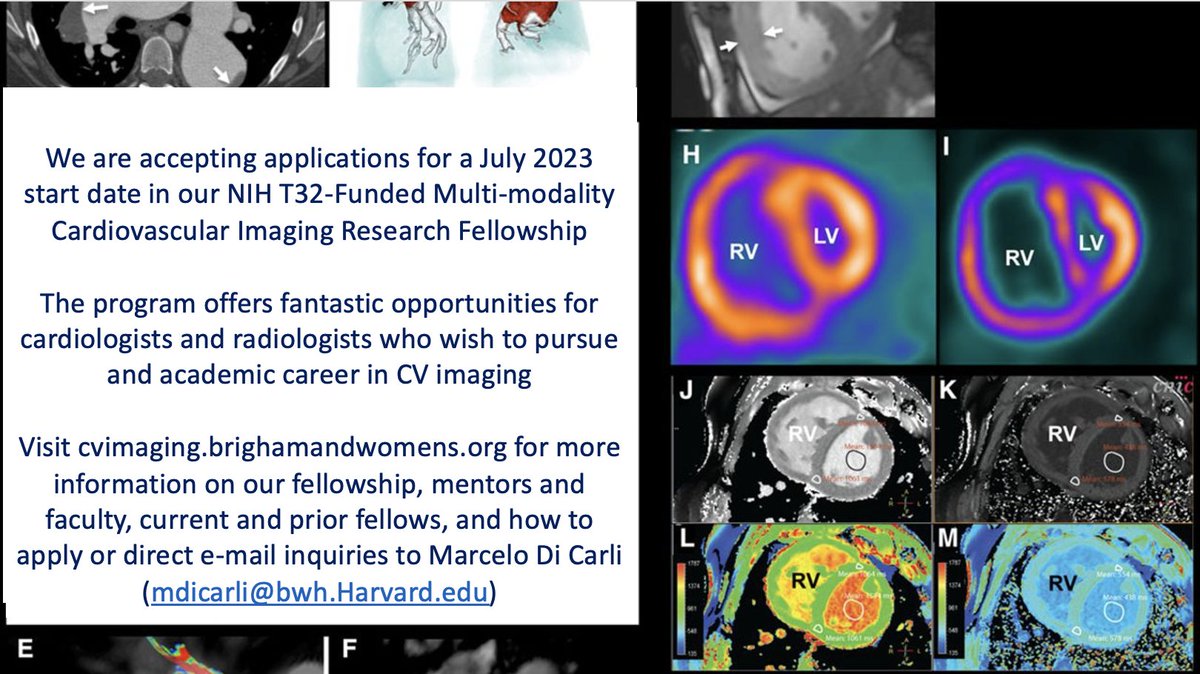 Here are some exciting opportunities for those interested in an academic career in CV imaging. @RonBlankstein @sanjaydivakaran #accimaging #accFIT #acccvtraining #accearlycareer @DorbalaSharmila @BWHCVImaging @bwhcvls @BrighamFellows @MGHCVFellows