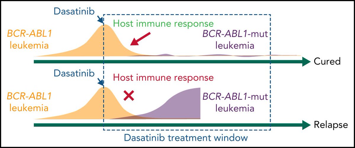Impact of T-cell immunity on chemotherapy response in childhood acute lymphoblastic leukemia loom.ly/G9SlL3c