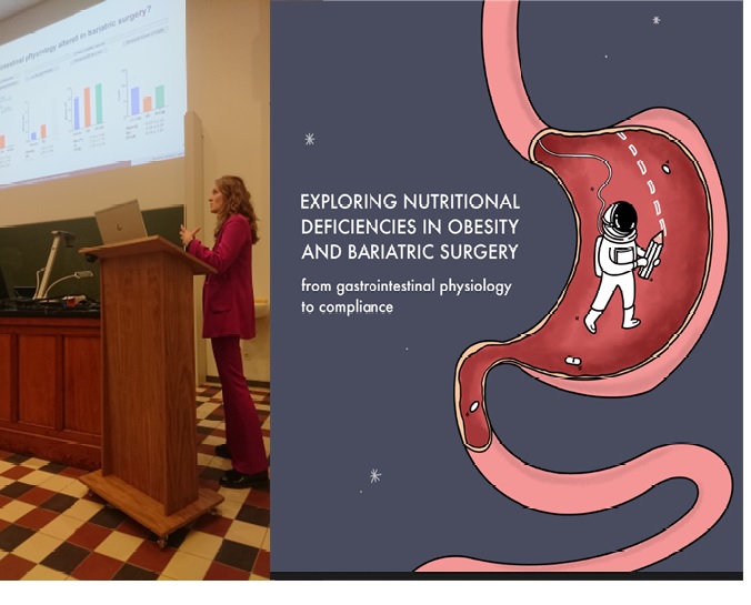 NutritionObesi1's tweet photo. What a day first we had our #bariatricsymposium, followed by the PhD Defense of @NeleSteenackers.
A succesful day well organised by @NeleSteenackers and a very nice PhD defense. #ladyinfuchia
Thx to #AlexanderMiras, #heikodeschepper, #TaraGrauwet & #JanTack as jury members. https://t.co/A5EblVvYyF