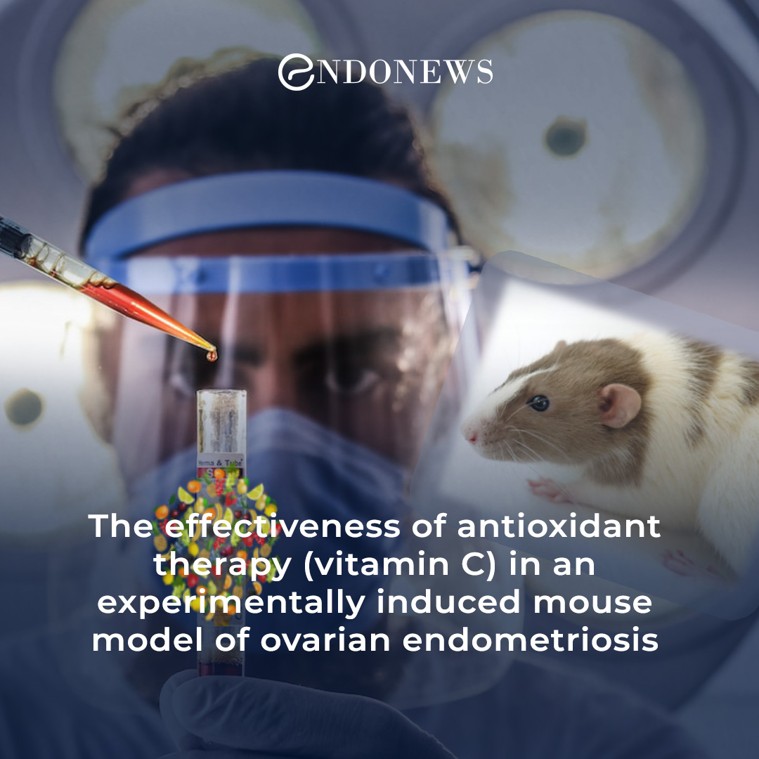 newsforendo's tweet image. An experimental mouse study indicates Vitamin C has favorable effects on endometriotic lesions

Read More:
endonews.com/vitamin-c-as-a…

#endometriosis #experimentalmodel #Vitamin C