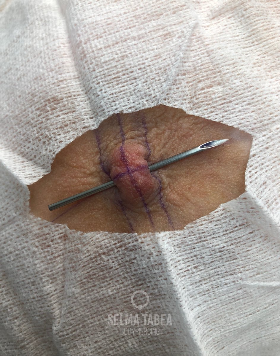 selmatabea13's tweet photo. Querem ver o resultado final? 👀
Perfuração realizada com jóia em titânio grau de implante cirúrgico! ❤️
#mamilo #nipple #nipplepiercing https://t.co/TTVIiz2Yp1