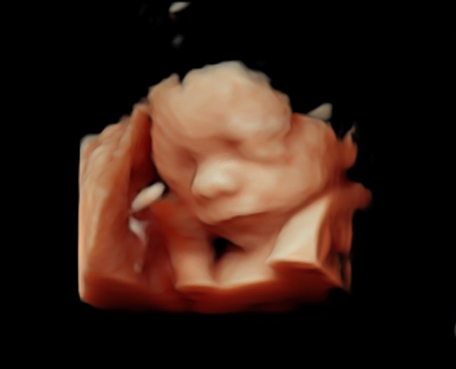 Just an example of how amazing these crystal do really turn out 🥺 This is my 3D ultrasound Scan turned into our stunning heart crystal and it came out truly stunning. #MaxPhoto #PhotoCrystals @maxspielmann