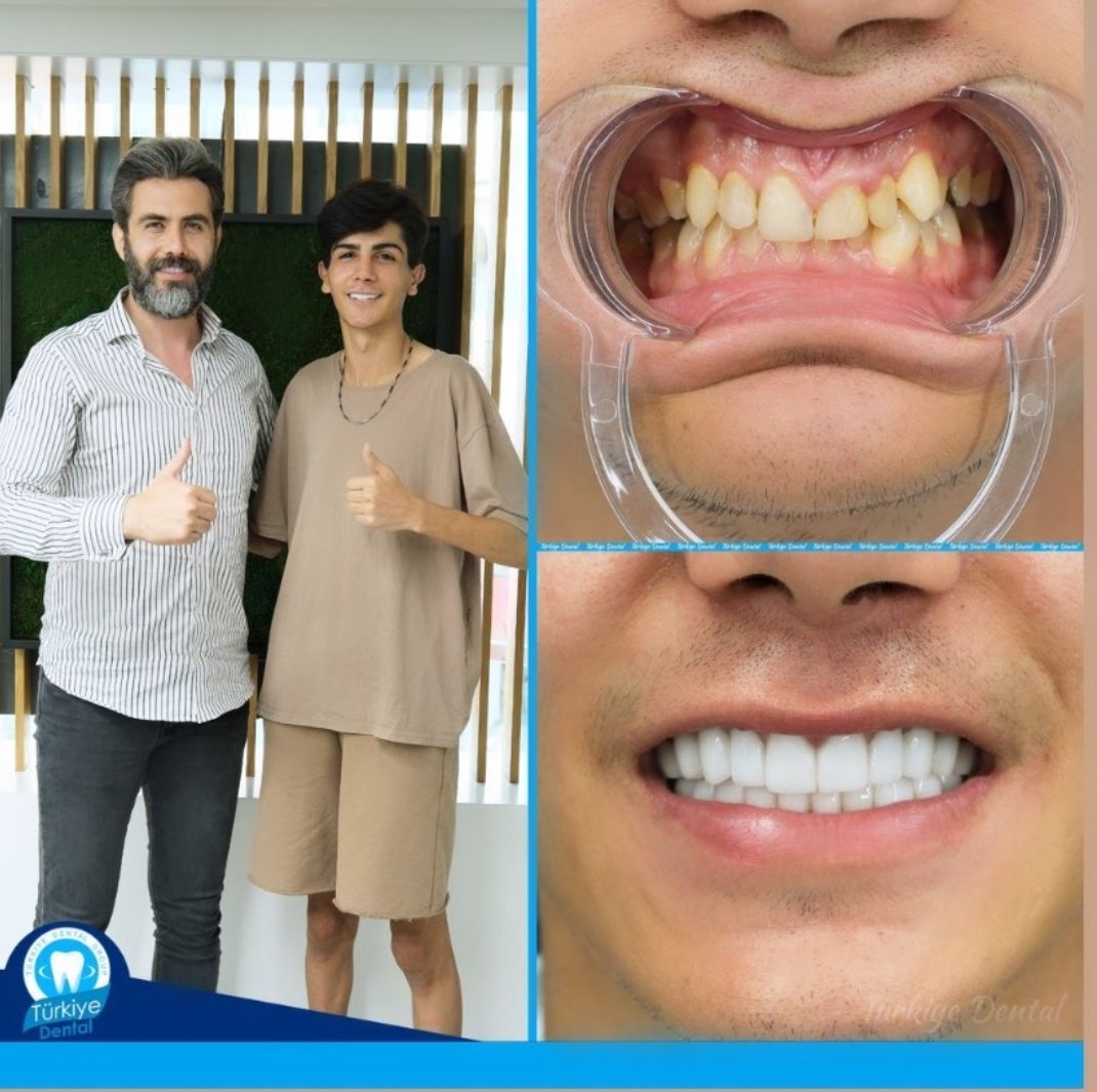 afilibirseyler's tweet photo. abi bu çocuk daha kaç yaşında bu dişler ne böyle 2yıl+3 haftalık dhf tecrübem bana hiç doğru hissetirmedi şu an https://t.co/rmjv4BwvoR