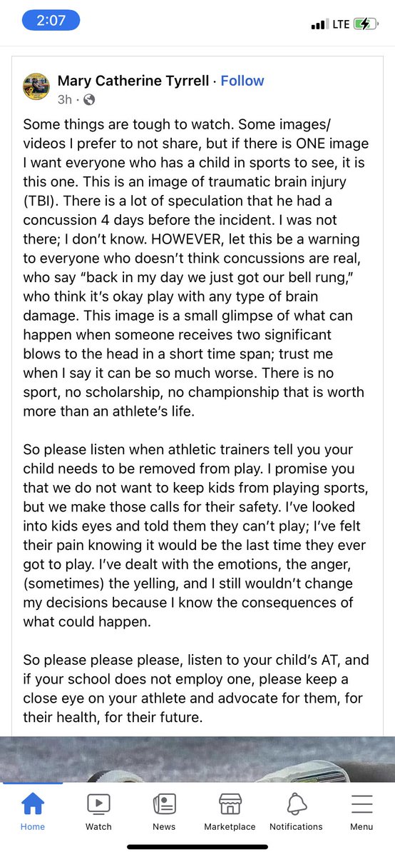 EvaBeaulieu's tweet image. There’s so much I could say in regards to concussions and the situation with Tua but this FB post I came across says it perfectly. Your child’s health is more valuable to me than another quarter, the next game, etc. I will always err on the side of caution.