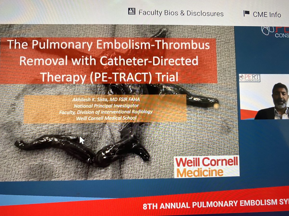 Oren Friedman (@orenfriedman) on Twitter photo <a href="/akhileshsistaMD/">Akhilesh Sista</a> congratulations for getting this important trial launched CDT vs AC - about time ! Thanks to your determination and grit #PERT2022 <a href="/akhileshsistaMD/">Akhilesh Sista</a> congratulations for getting this important trial launched CDT vs AC - about time ! Thanks to your determination and grit #PERT2022