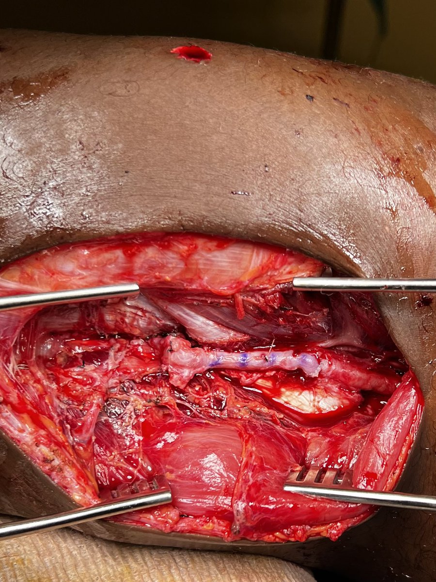 Jason Ty Turner tweet media