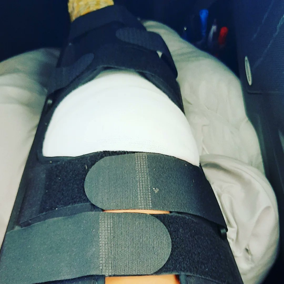 Rusteia's tweet photo. My #meniscalrootrepair aka my #kneearthroscopy aka #kneesurgery journey today! That #generalanesthesia had me passing out left and right on the way home. Even had me stir crazy trying to clean my room!! Grrr. . I will let go of my OCD soon and relax!! #dayone #happyfriday 🦵🏽🍗🦿 https://t.co/8LX1QgcWN4