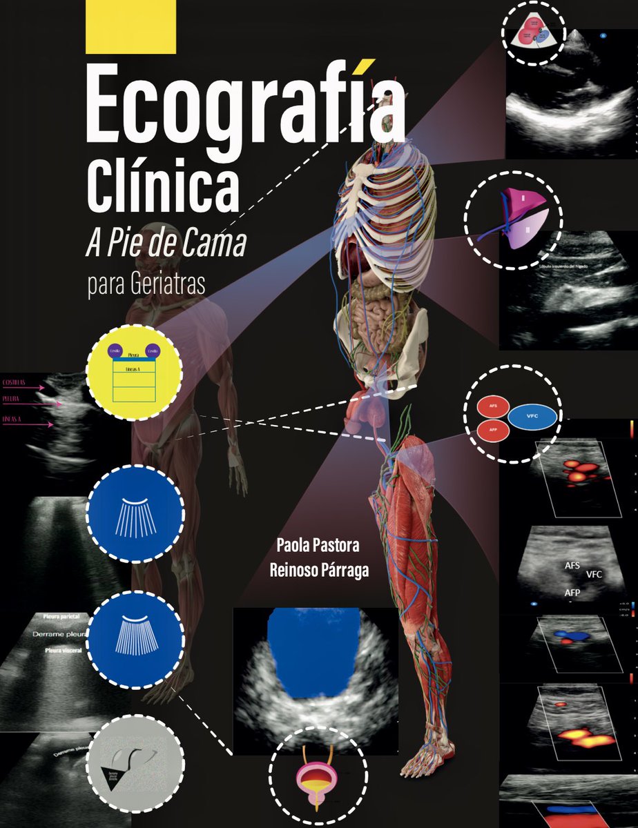 Paola Reinoso Párraga (@paolareinosop) on Twitter photo It has been an honor for me that my first book had been presented at the 18th Congress of the European Geriatrics Medicine Society (EuGMS) in London. All this effort has been worth it. Thanks for all the support. <a href="/GeriatriaLaPaz/">Geriatría Hospital U. La Paz</a> <a href="/Wally_Gator_MD/">Juan I González Montalvo</a> <a href="/EuGMSSociety/">EuGMS - European Geriatric Medicine Society</a> <a href="/GeriSoc/">British Geriatrics Society</a> It has been an honor for me that my first book had been presented at the 18th Congress of the European Geriatrics Medicine Society (EuGMS) in London. All this effort has been worth it. Thanks for all the support. <a href="/GeriatriaLaPaz/">Geriatría Hospital U. La Paz</a> <a href="/Wally_Gator_MD/">Juan I González Montalvo</a> <a href="/EuGMSSociety/">EuGMS - European Geriatric Medicine Society</a> <a href="/GeriSoc/">British Geriatrics Society</a>