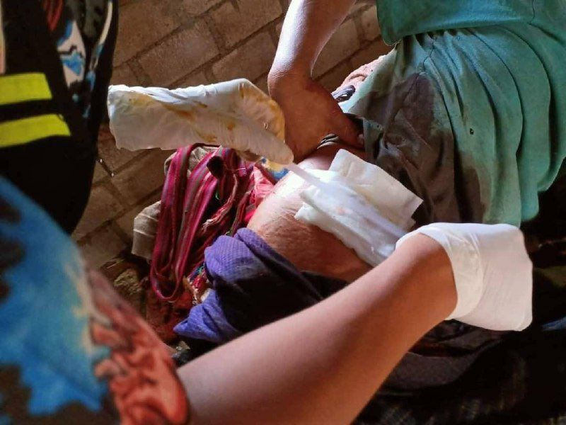 2 residents died and 4 got injured what with the shelling of artilleries by junta soldiers in Pasarnyay village, Loikaw tsp, Kayah state on 17th Sep.  #2022Sept19Coup #SaveMyanmarChildren #WhatsHappeningInMyanmar