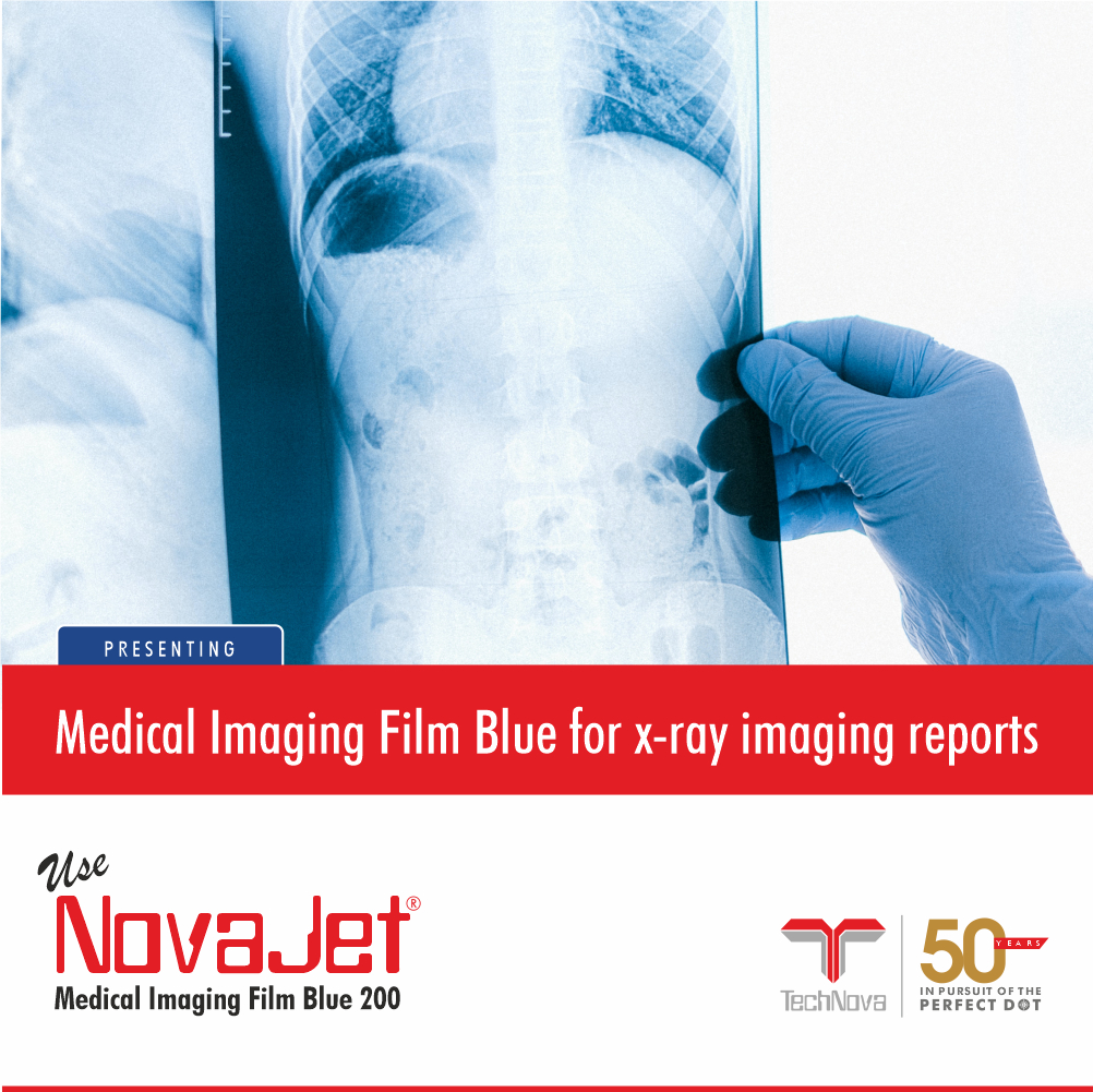 TechNovaWorld's tweet photo. #NovaJet Medical Imaging Film Blue 200 (MIFB 200) from #TechNova is an inkjet printable film designed for printing X-Ray imaging reports.
Click to know more https://t.co/jWHPNk7z0X

#digitalprintmedia #medicalreports #healthcare #medical #xray  #MIFB #inkjetxrayfilm #xrayfilm https://t.co/nETAd9iQCe