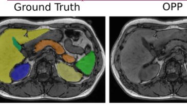 AbdomenNet for abdominal organ segmentation in epidemiologic imaging studies (UKBiobank, Nationale Kohorte, KORA) is now online.

bmcmedimaging.biomedcentral.com/articles/10.11…