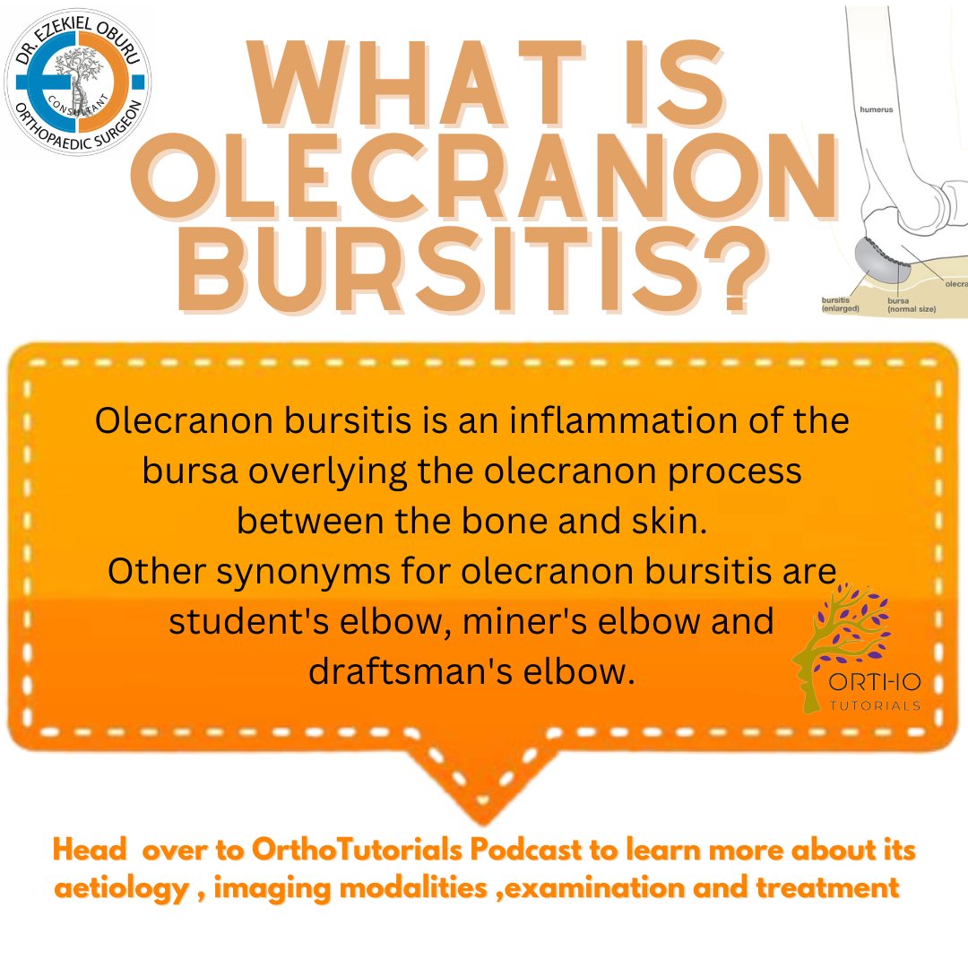 drezekieloburu's tweet photo. Learn more about Olecranon Bursitis over at @orthopaedictutorials Podcast . #orthopedicsurgeon #orthopedicsurgeonsinkenya #doctorsinkenya #kenyanpodcasters #learnsomethingnewdaily #olecranonbursitis #studentselbow #orthopedicpodcast #orthopedicspecialistskenya https://t.co/JiW6CsvdkQ