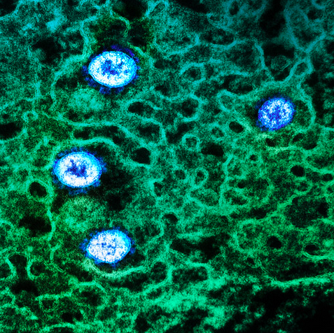 BA.2.75.2, le nouveau sous-variant d’Omicron qui inquiète les scientifiques. À lire sur 'Réalités Biomédicales' lemonde.fr/blog/realitesb…