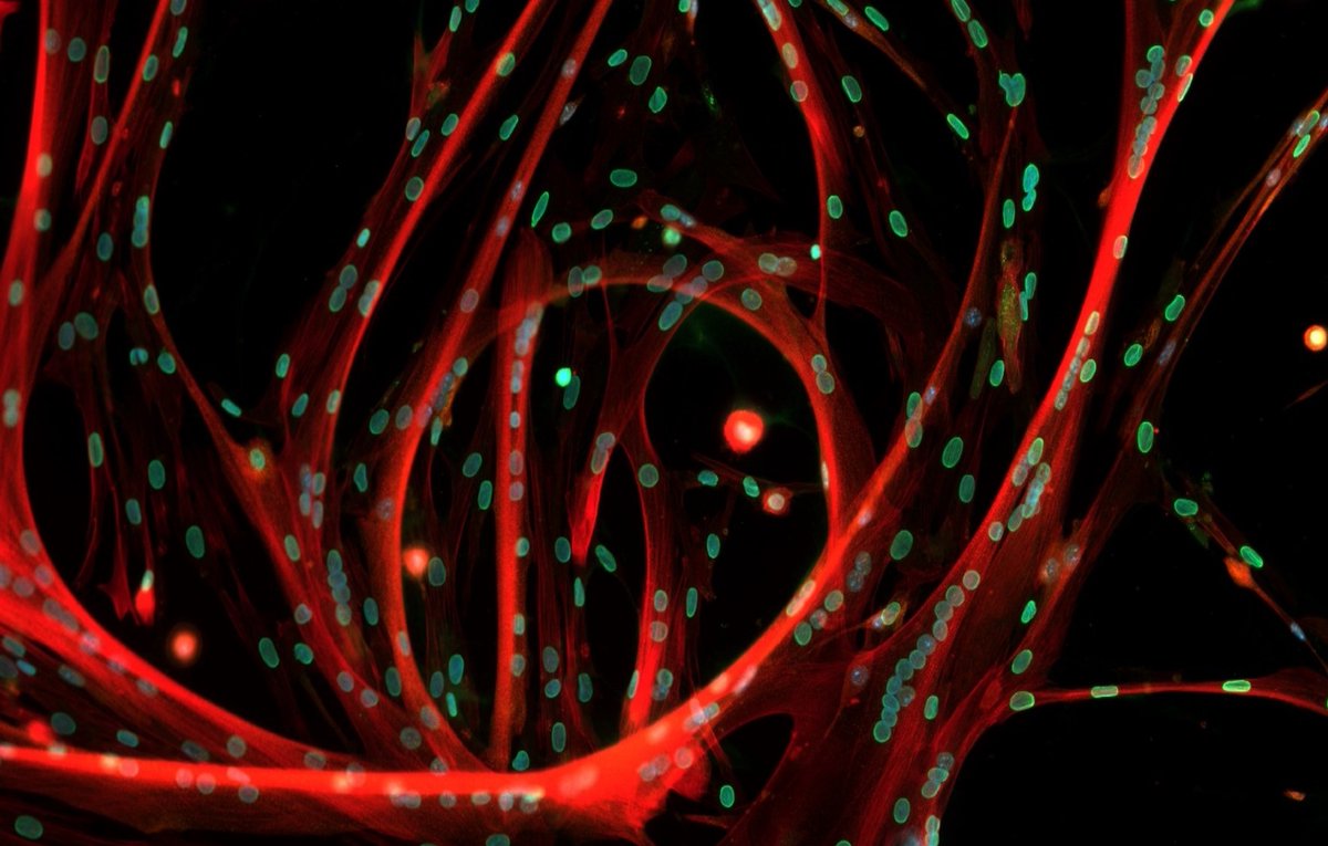 Marine Biological Laboratory (MBL) (@mblscience) on Twitter photo It's #MicroscopyMonday, so let's take a dive under the 🔬
This image shows multinucleated skeletal muscle cells form connections with multiple muscle precursor cells. Nuclei are in green and cell is in red.
Credit: Helena Pinheiro (<a href="/helenaapinheiro/">Helena Pinheiro</a>) It's #MicroscopyMonday, so let's take a dive under the 🔬
This image shows multinucleated skeletal muscle cells form connections with multiple muscle precursor cells. Nuclei are in green and cell is in red.
Credit: Helena Pinheiro (<a href="/helenaapinheiro/">Helena Pinheiro</a>)