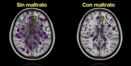 drrobertnunez's tweet photo. Interesante Evidencia Científica sobre el maltrato a los Niños.

Cuando el niño recibe: negligencia o abuso físico, emocional o sexual durante la infancia. https://t.co/ZgrookWvY1