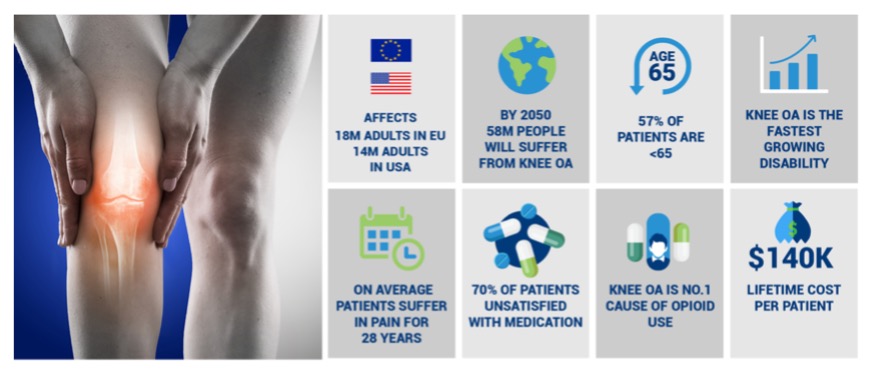 Delighted to announce our 5th <a href="/ERC_Research/">European Research Council (ERC)</a> grant <a href="/TMDLab/">TMDLab</a>  (this time an ERC-Consolidator award). This 5-yr grant will focus on new disruptive treatments for chronic OA pain. Only possible via support from <a href="/Galway_Research/">University of Galway Research & Innovation</a>'s medtech eco-system, <a href="/IrishResearch/">We are now Research Ireland</a>  and @scienceirel