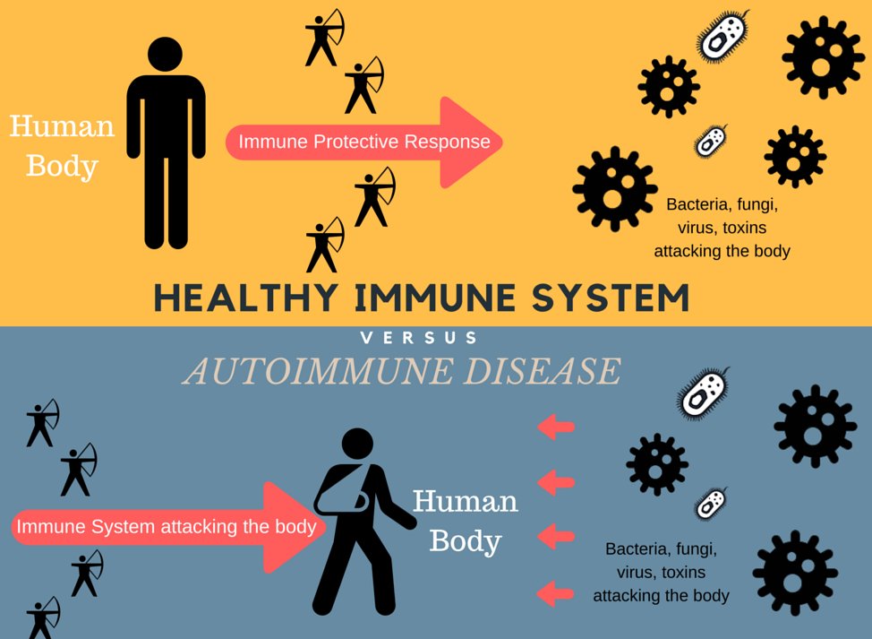 MediCorpGlobal's tweet photo. An autoimmune disorder occurs when the immune system fails to differentiate between self and non-self-substances, leading to the destruction of its body cells &amp; subsequently affecting work performance. MediCorp medical team can offer telemedicine and consulting support #wellness https://t.co/CnfH2hwZCK