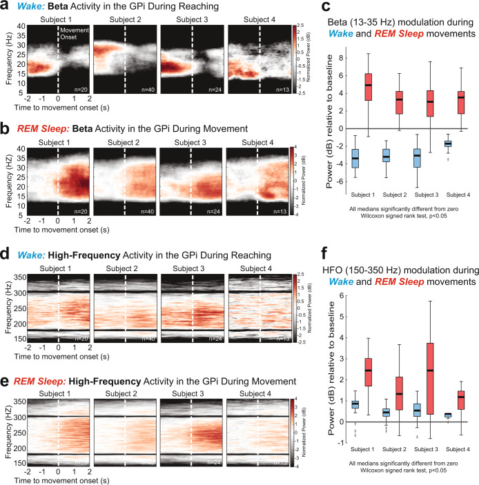 umnneurosurgery's tweet photo. Basal ganglia engagement during REM sleep movements in Parkinson's disease | Faculty member Dr. Michael C. Park a coauthor | #Parkinsons | https://t.co/WCjNZdNrBl https://t.co/Q5nXVPwwM2
