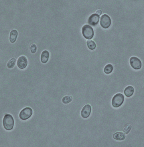 <a href="/CDCgov/">CDC</a>  fungal awareness week: No 2 genus at #NRZMyk is Candida: DYK it comprises species that are phylogenetically far apart? Beside the clinical frontrunner C. albicans, resistant C. glabrata and spread of C. auris (image) are in the focus – these 3 are only distantly related!